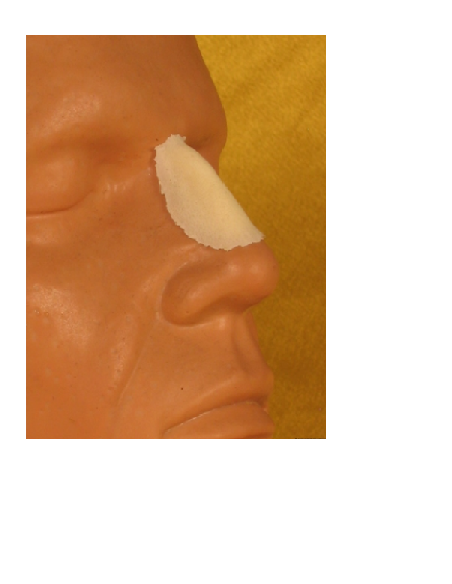 Prothèse FRW008 petit nez aquilin BURMAN