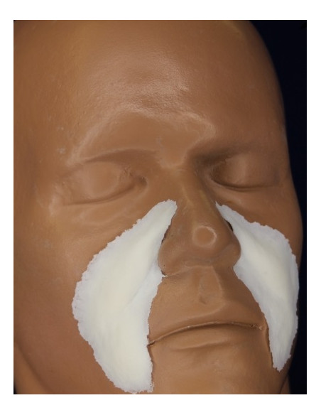 Prothèse FRW080 nasal labials BURMAN