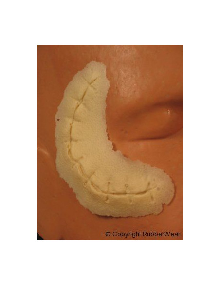 Prothèse FRW059 petite coupure suture  BURMAN