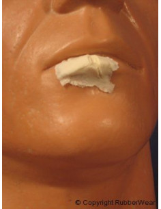 Prothèse FRW022 petite lèvre fendue BURMAN
