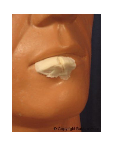 Prothèse FRW021 large lèvre fendue BURMAN