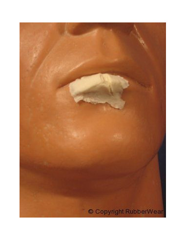 Prothèse FRW022 petite lèvre fendue BURMAN