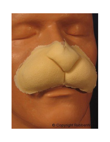 Prothèse FRW051 nez de lapin  BURMAN