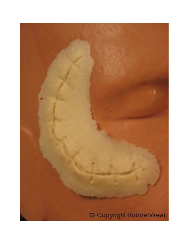 Prothèse FRW059 petite coupure suture  BURMAN