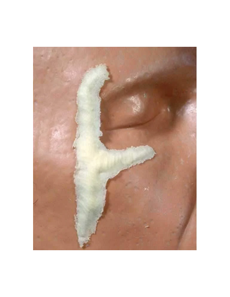 Prothèse FRW062 Y cicatrice BURMAN