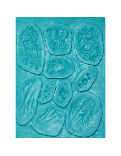 Moule prothèse N°SOS IIB plaque de brûlures silicone MEL PRODUCTION