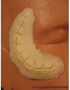 Prothèse FRW059 petite coupure suture  BURMAN