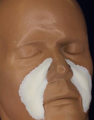 Prothèse FRW080 nasal labials PLEIN FARD 
