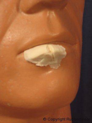 Prothèse FRW021 large lèvre fendue BURMAN